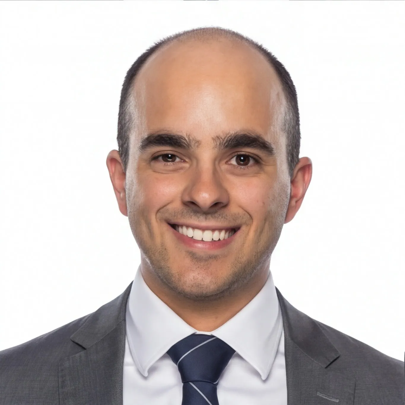 Hair loss simulation