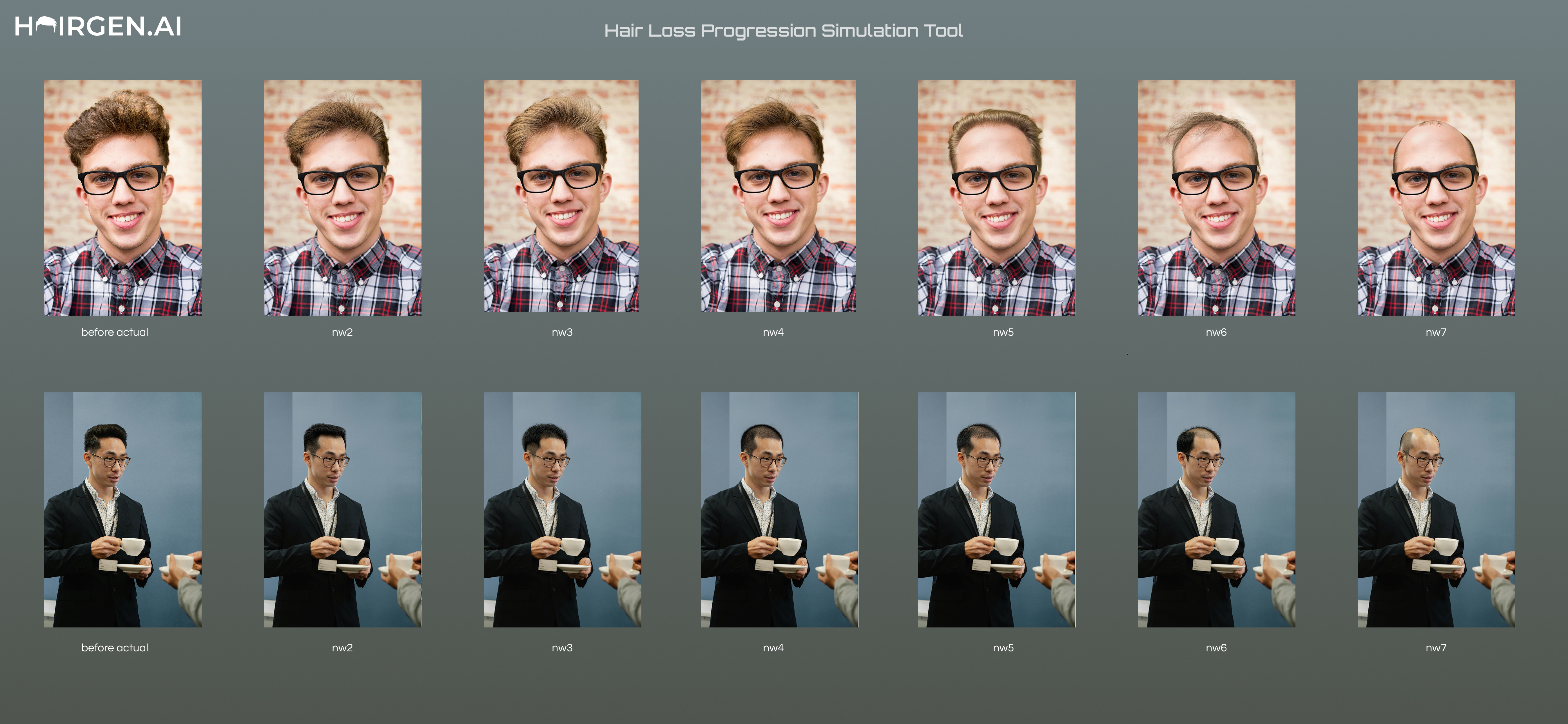 Hair Loss Progression Simulation