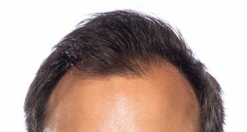 Cropped face
