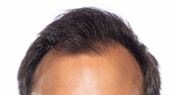 Cropped face