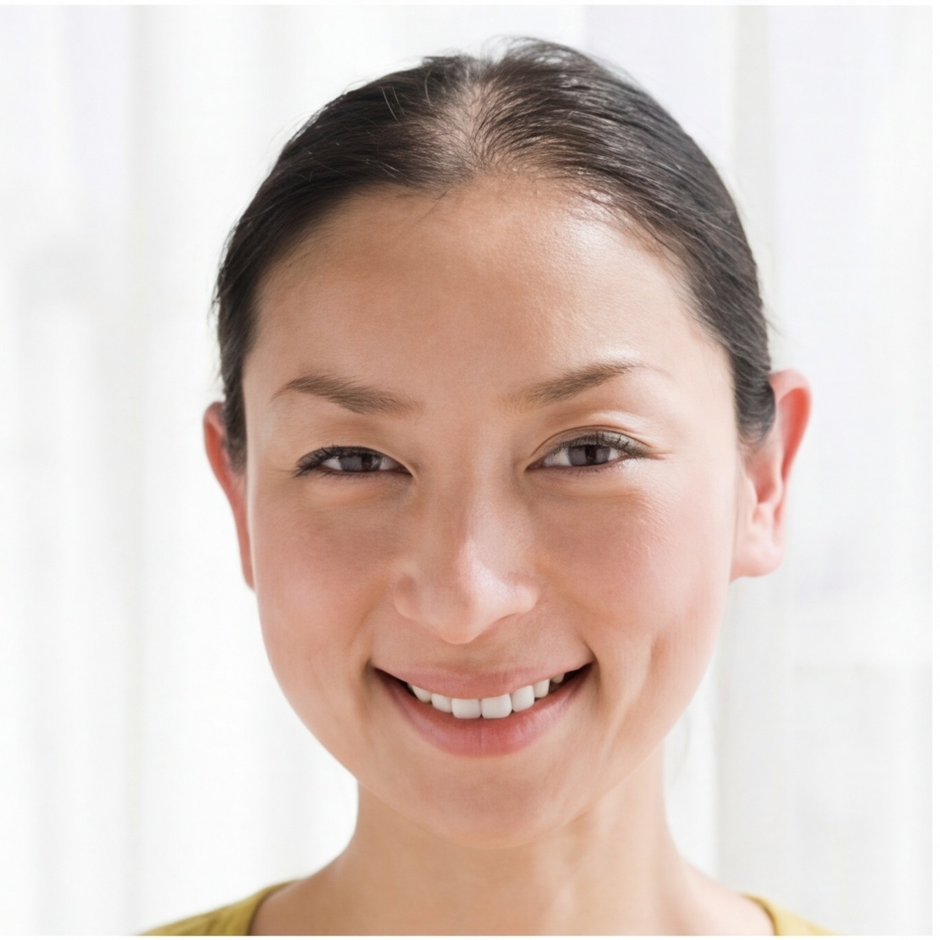 Hair loss simulation