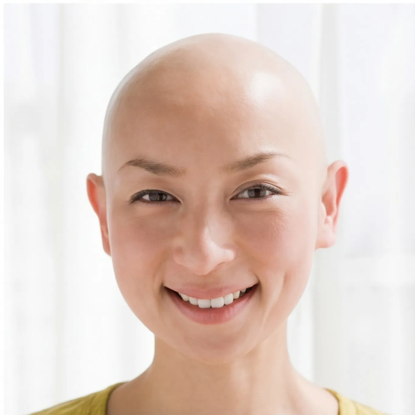 Hair loss simulation